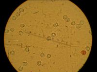 spores E clypeatum2